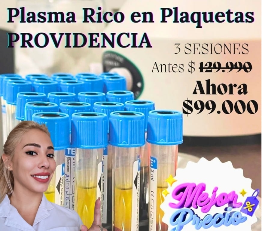 Masajes Santiago Providencia - Fotos de Plasma Rico en Plaquetas Facial y Capilar