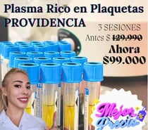 Plasma Rico en Plaquetas Facial y Capilar